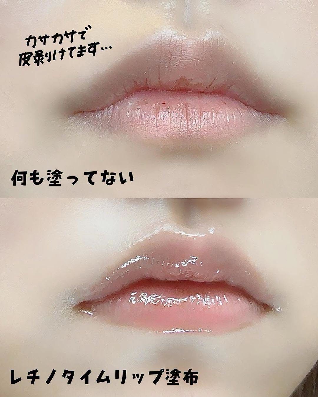 The Retinotime Wrinkle Lip Essence Plumper