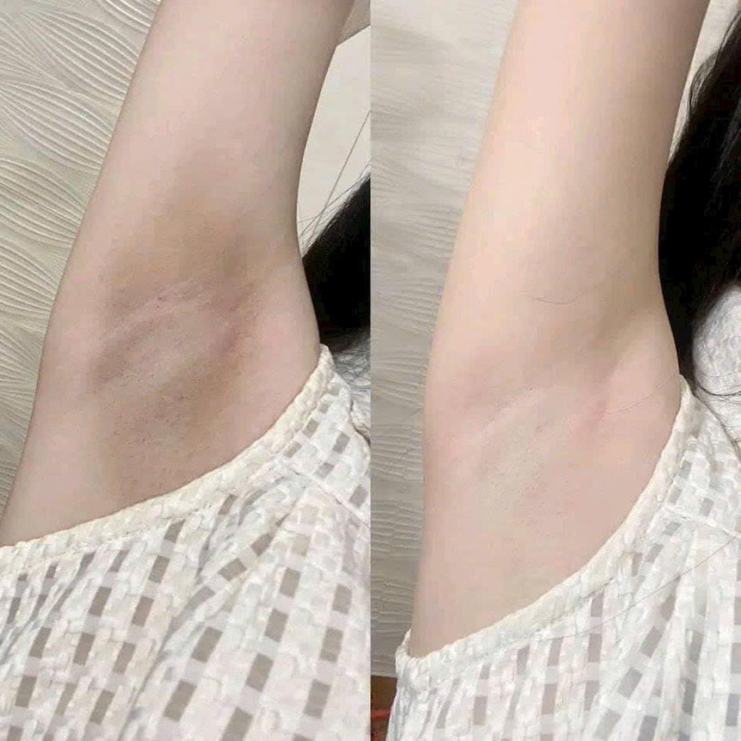 Himecoto Underarm Brightening Cream (Japan)