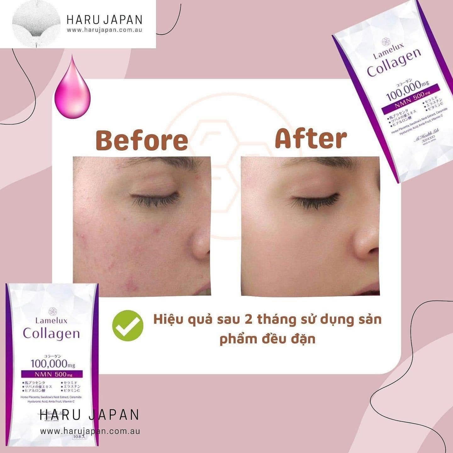 Aishodo Lamelux Collagen NMN 30 sticks for 30 days