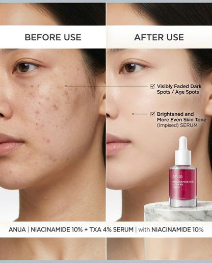 Anua Niacinamide 10% Txa 4% 30ml
