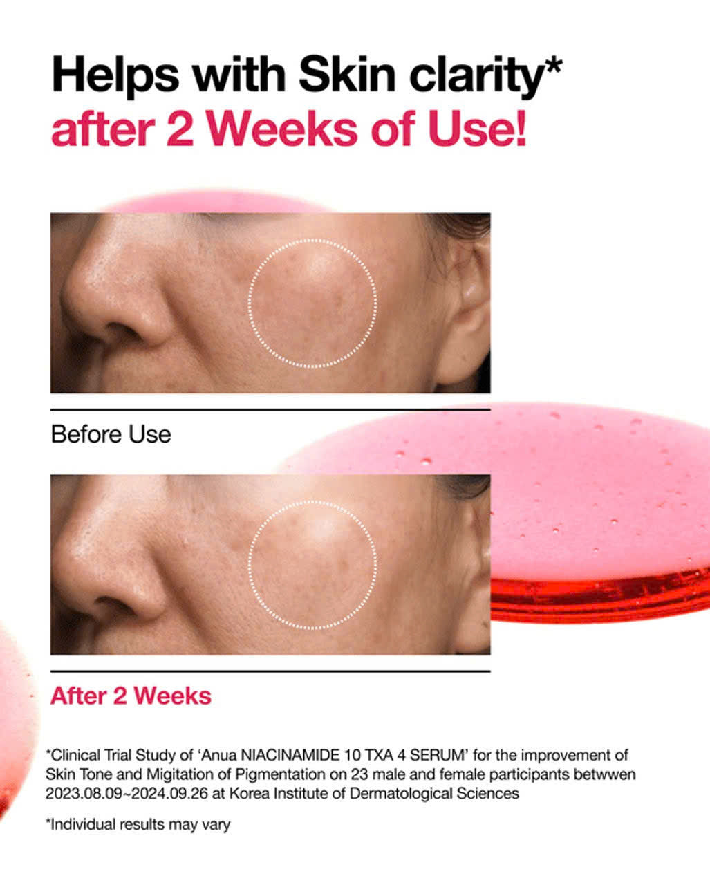 Anua Niacinamide 10% Txa 4% 30ml
