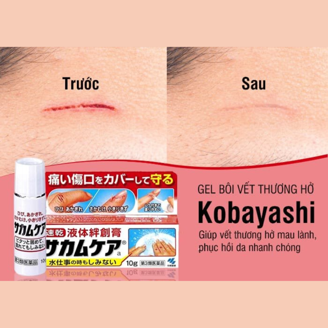 Kobayashi Wound-Healing Gel