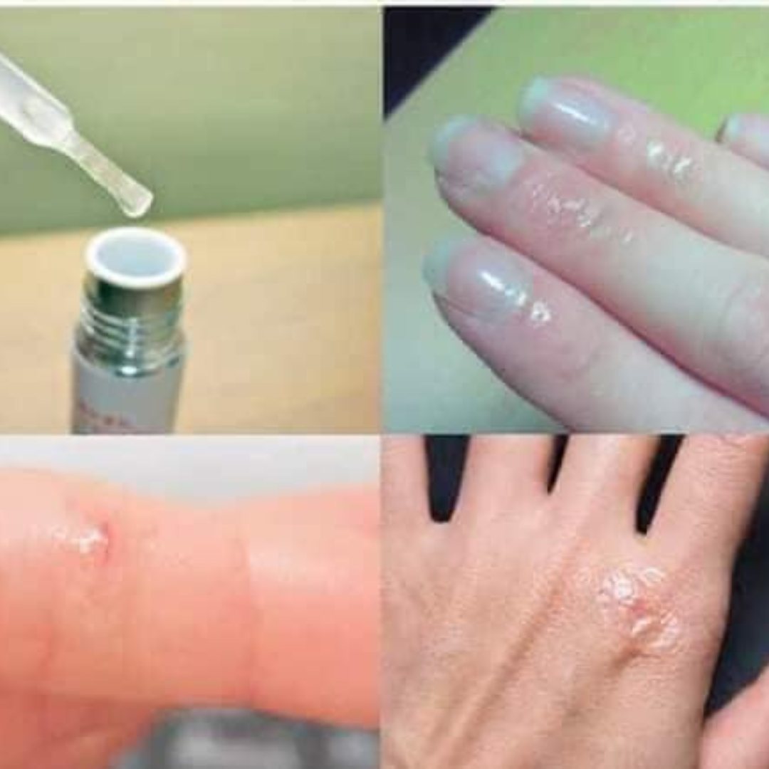 Kobayashi Wound-Healing Gel