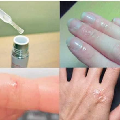 Kobayashi Wound-Healing Gel