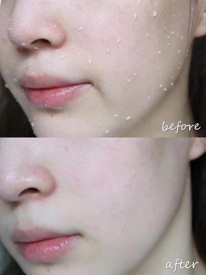 💧 Cure Natural Aqua Gel – Japan’s #1 Exfoliator for Over 10 Years 🇯🇵