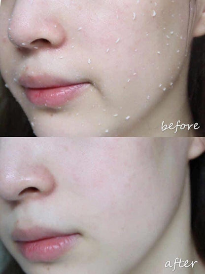 💧 Cure Natural Aqua Gel – Japan’s #1 Exfoliator for Over 10 Years 🇯🇵