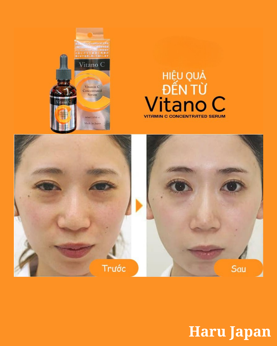 Serum Vitano C Concentrated - Made in Japan – Tinh chất Vitamin C đậm đặc từ Nhật Bản