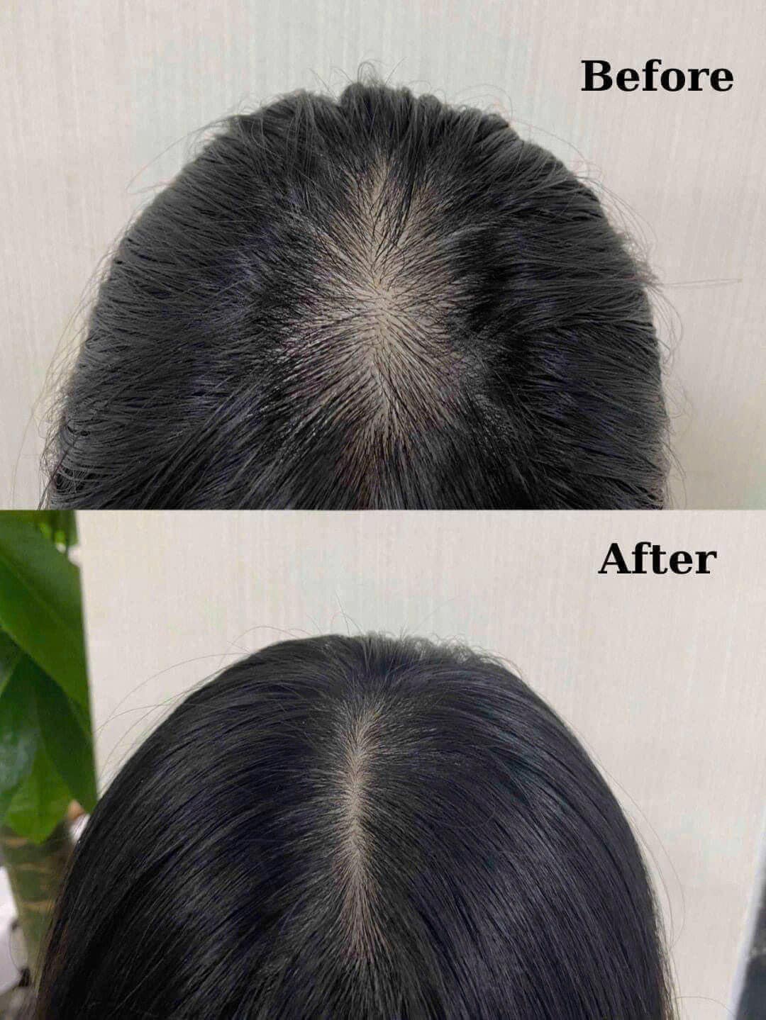 Aromatica Rosemary Root Enhancer - Made in Korea