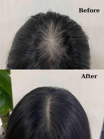 Aromatica Rosemary Root Enhancer - Made in Korea