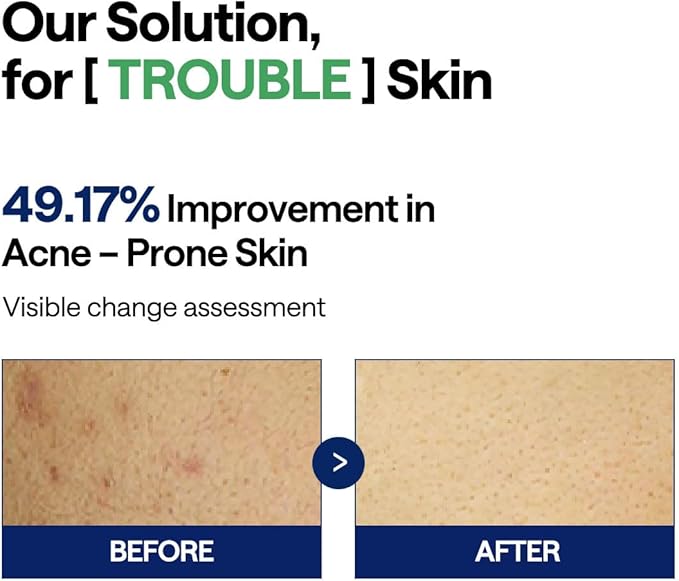 🌿 Mediheal Tea Tree Trouble Pad – Made in Korea