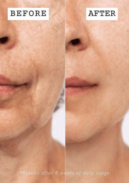 PURE RETINOL HIGH CLASS MOIST CREAM - MADE IN JAPAN