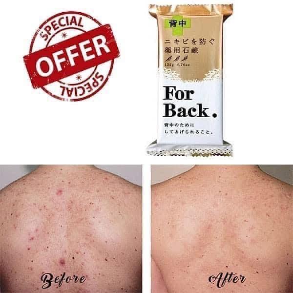 Pelican Back Acne Soap For Back 135g – Made in Japan