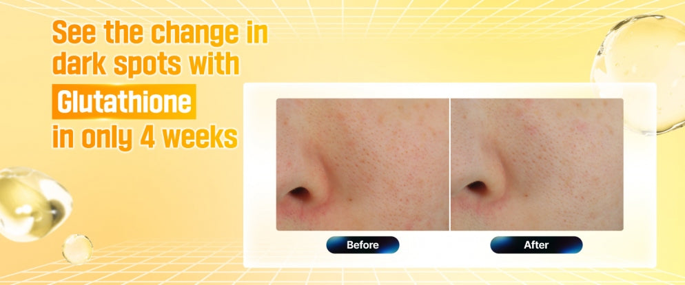 Numbuzin No.5+ Vitamin Glutathione Dark Spot Laser Cream