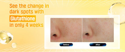 Numbuzin No.5+ Vitamin Glutathione Dark Spot Laser Cream