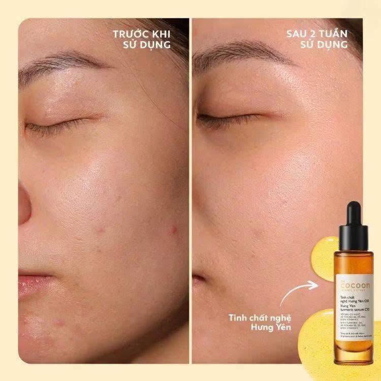 Cocoon Hung Yen tumeric serum C10 30ml