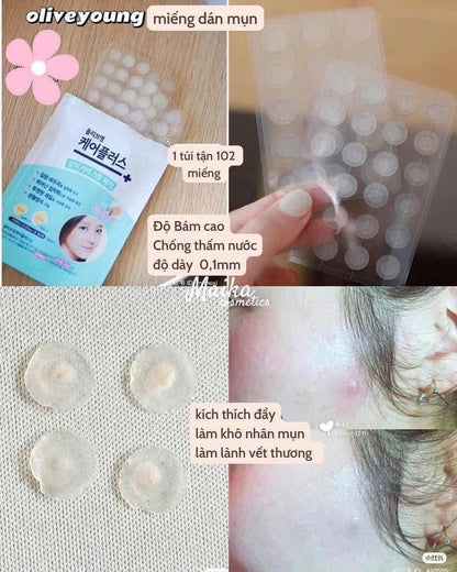 Careplus acne scar cover patch 102pcs