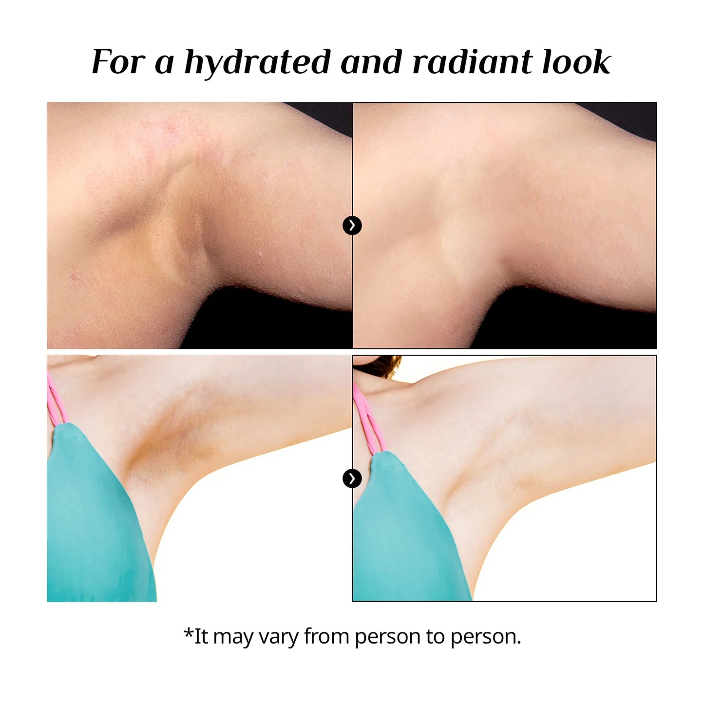BND UNDERARM & ARMPIT CREAM - MADE IN KOREA