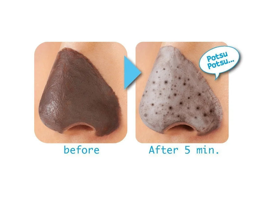 🌸 TSURURI Point Clay Pack Ex – Deep Pore Cleansing & Oil-Control Mask 🌸