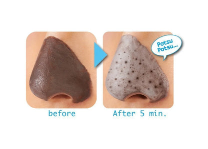 🌸 TSURURI Point Clay Pack Ex – Deep Pore Cleansing & Oil-Control Mask 🌸