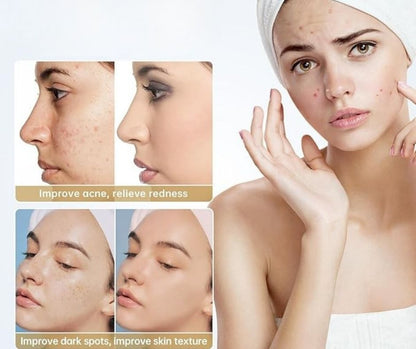 ANCIENTE AZELAIC ACID & NIACINAMIDE ESSENCE - MADE IN JAPAN