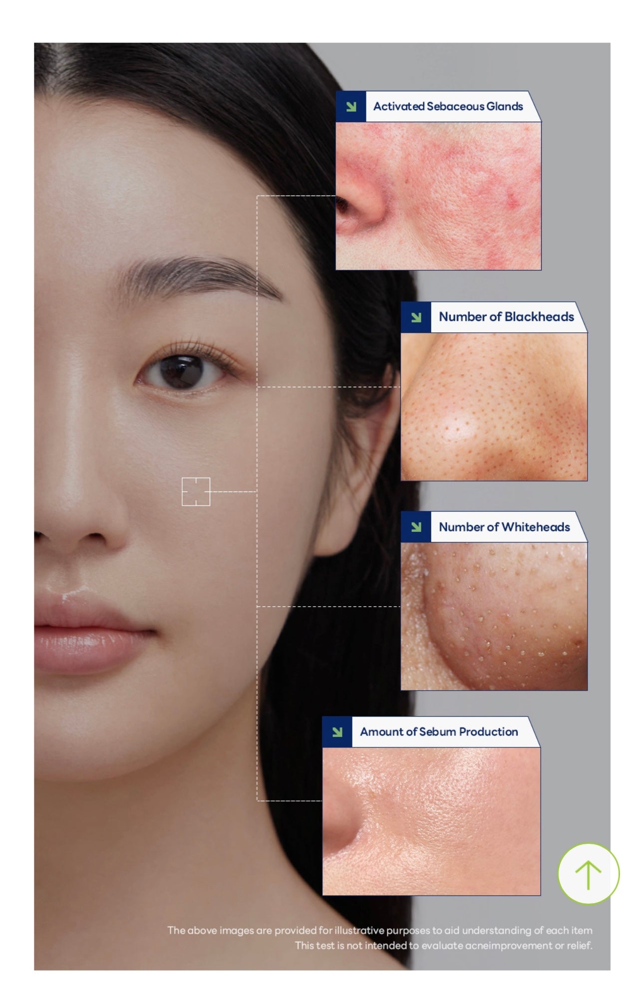 🌿 Mediheal Tea Tree Trouble Pad – Made in Korea