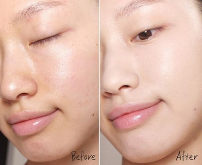 KEANA BEAUTE VC15 ESSENCE - MADE IN JAPAN