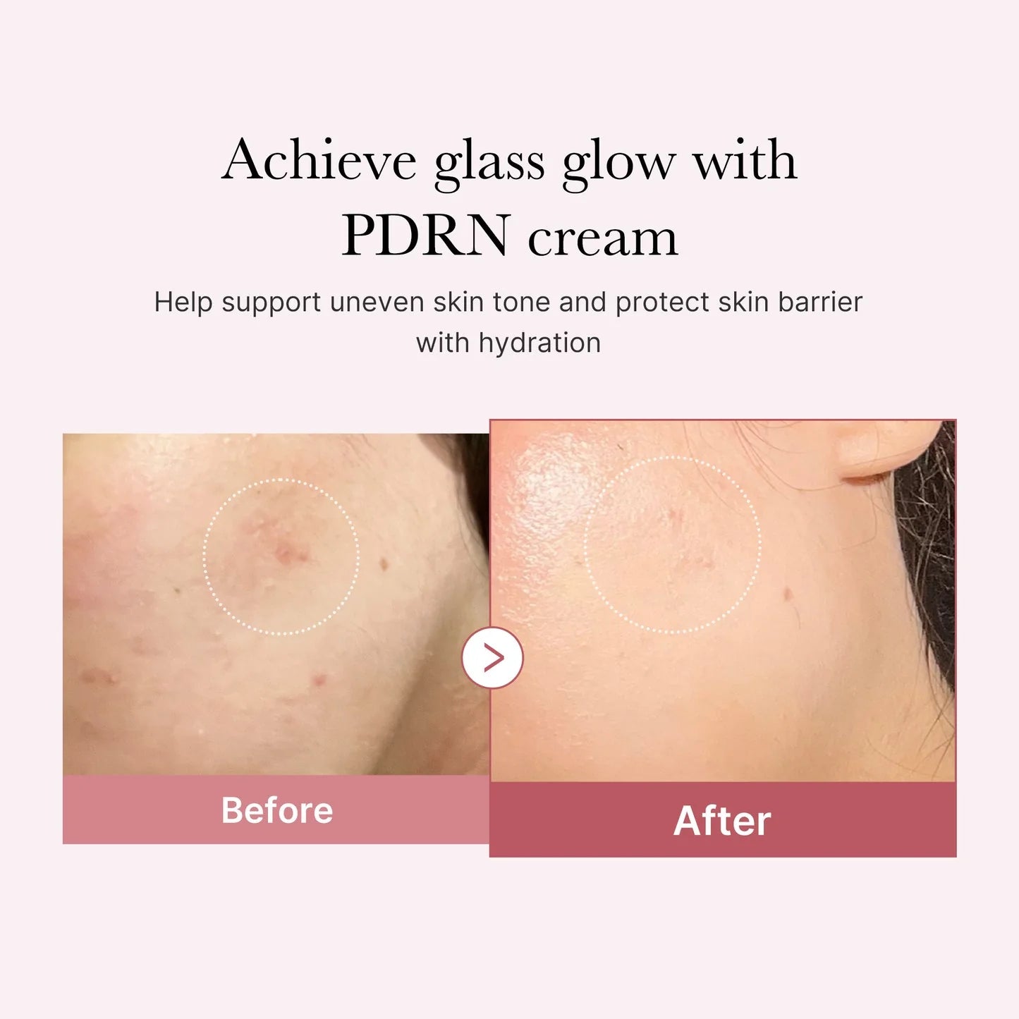 Gel Dưỡng Medicube PDRN Hyaluronic Moisturizing Gel Cream