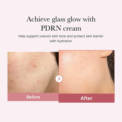Gel Dưỡng Medicube PDRN Hyaluronic Moisturizing Gel Cream