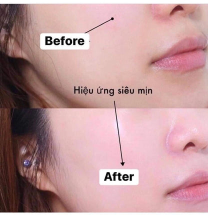 Cell Fusion C Dark Spot Sunscreen – Adorable My Melody Edition