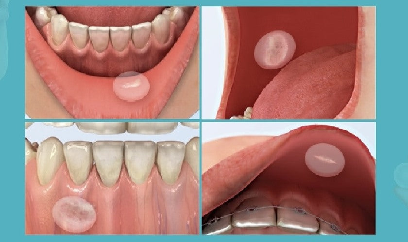 DAIICHI SANKYO ORAL CARE DUO - Made in Japan