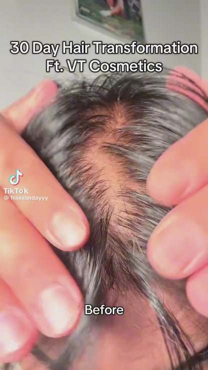 💚 VT Reedle Shot Hair Boosting Ampoule 15mL x2