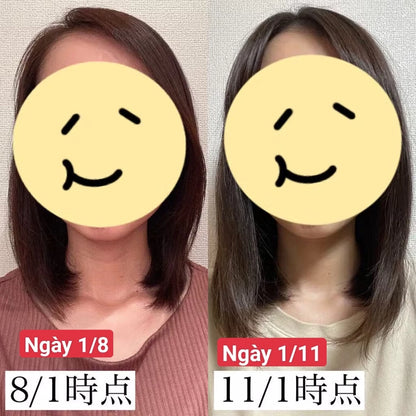 KAMINOMOTO HAIR ACCELERATOR EX - MADE IN JAPAN